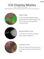 ⁦نظام كاميرا كامجوي CK701 4K ICG مزدوج 4K لنظام الفلورة الداخلية⁩ - الصورة ⁦6⁩