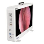 كامجوي CF916 محمول 15.6 FHD نظام كاميرا تنظير داخلي وحدة الأذن والحنجرة الشاملة FHD 03