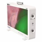 كاميرا كامجوي CG932 32 بوصة 4K-ICG FPGA نظام كاميرا منظار 02