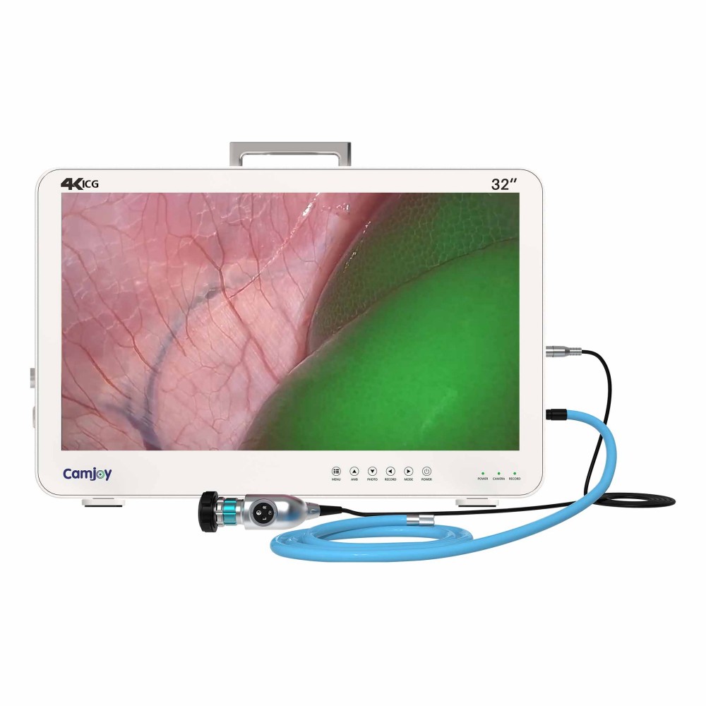 Camjoy CG932 32 4K-ICG FPGA Endoscope Camera System 01 Camjoy CG932 32inch 4K-ICG FPGA Endoscope Camera System 01