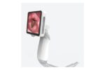 Camjoy LR101 Reusable-Blade Video Laryngoscope detail image 2