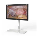 Camjoy CF1 22-inch black FHD surgical monitor perspective view