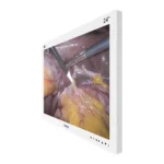 Camjoy CK0 24-inch white 4K surgical monitor side view