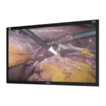 Camjoy CK1 43-inch black 4K surgical monitor perspective view